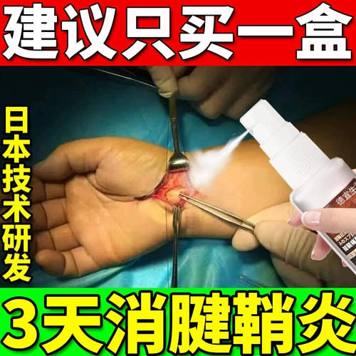 Сундоносиноворативные запястья, приведенные в пасты, кисты